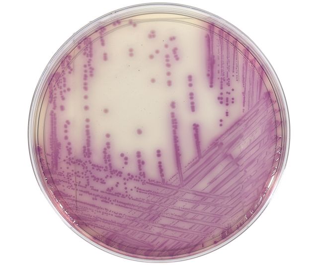 HardyCHROM Salmonella, Chromogenic Medium, 15x100mm Plate. 10 per package